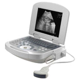 Portable all-digital notebook medical ultrasound scanner + convex array probe